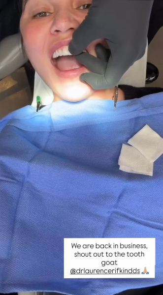 Chrissy Teigen in a dentist chair receiving a new veneer